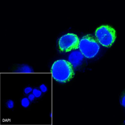 Kappa light chain Recombinant Rabbit mAb (S-385-23)
