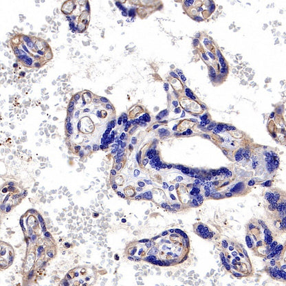 VEGF Receptor 2/FLK-1 Recombinant Rabbit mAb (S-R400)