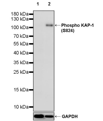 Phospho KAP-1 (S824) Recombinant Rabbit mAb (S-986-9)