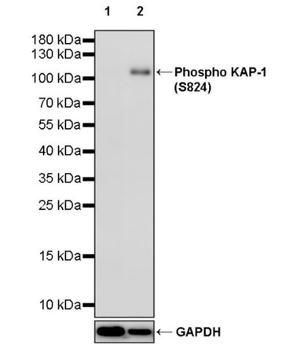 Phospho KAP-1 (S824) Recombinant Rabbit mAb (S-986-9)
