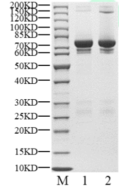 CSNK1G3(CK1γ3) GST Tag Protein, Human