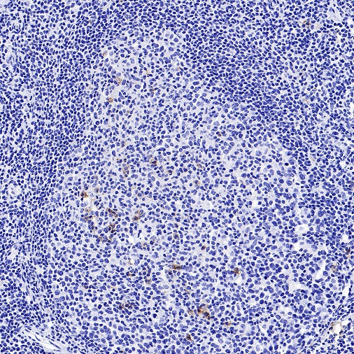 CD138 Recombinant Rabbit mAb (S-417-199)