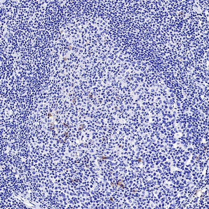 CD138 Recombinant Rabbit mAb (S-417-199)