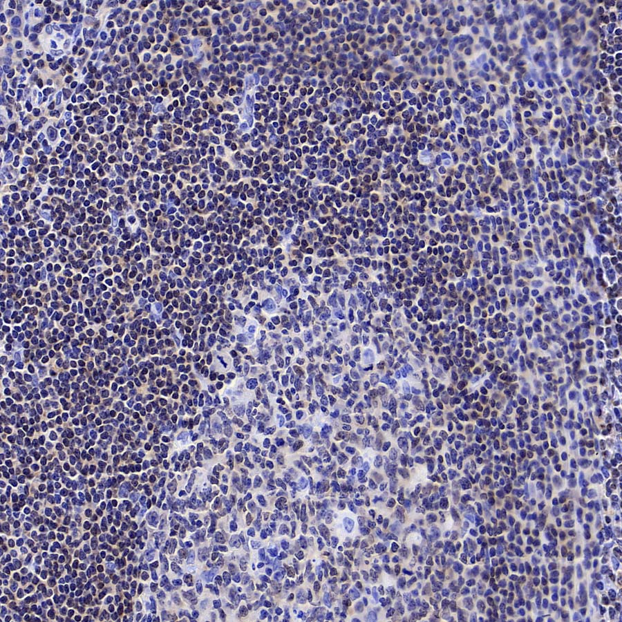 FoxO1 Recombinant Rabbit mAb (S-5118)