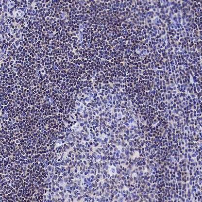 FoxO1 Recombinant Rabbit mAb (S-5118)