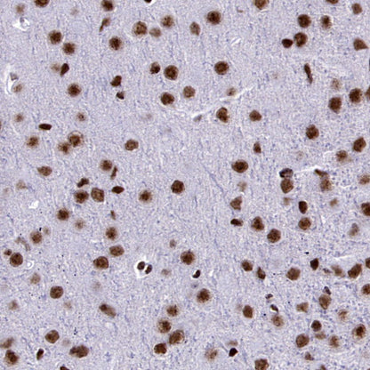 WTAP Recombinant Rabbit mAb (S-2741-49)