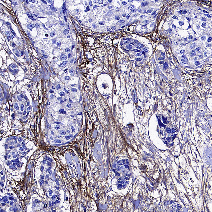 TGFBI / BIGH3 Mouse mAb