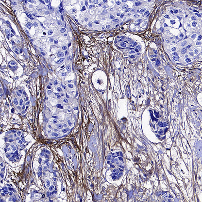 TGFBI / BIGH3 Mouse mAb