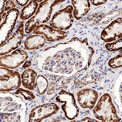 DLST Recombinant Rabbit mAb (S-2283-10)