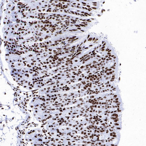 Histone H4 (Lactyl K8) Recombinant Rabbit mAb (S-3243-36)