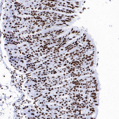 Histone H4 (Lactyl K8) Recombinant Rabbit mAb (S-3243-36)