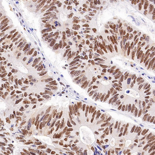 Cyclin K Recombinant Rabbit mAb (S-1586-18)