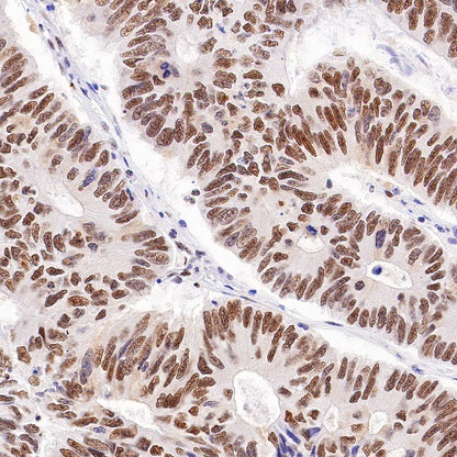 Cyclin K Recombinant Rabbit mAb (S-1586-18)