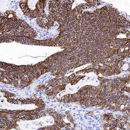 CDH17 Recombinant Rabbit mAb (SDT-3276-83)