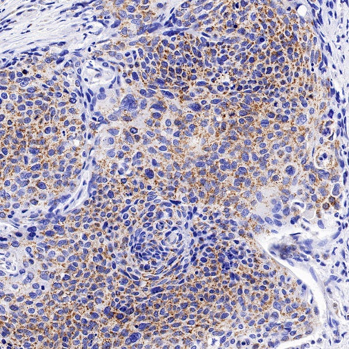 TFAM Recombinant Rabbit mAb (S-1018-53)