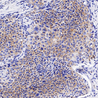 TFAM Recombinant Rabbit mAb (S-1018-53)
