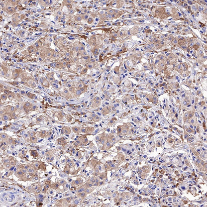 Atg7 Recombinant Rabbit mAb (S-R302)