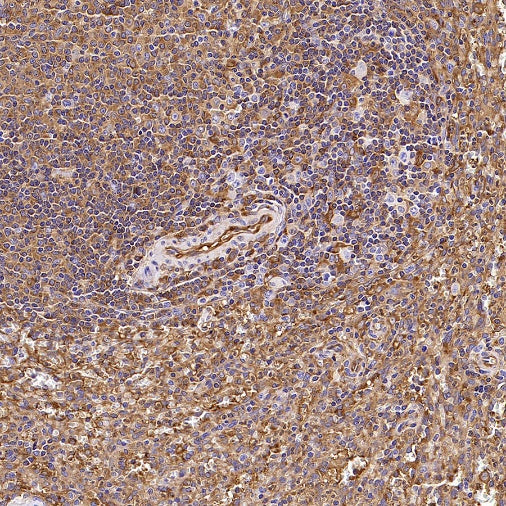 IFIT3 Recombinant Rabbit mAb (S-1893-45)