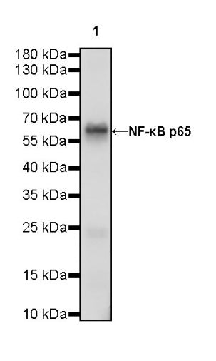 NF-κB p65 Recombinant Rabbit mAb (S-475-56)
