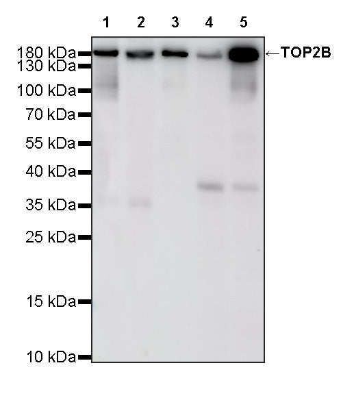 TOP2B Recombinant Rabbit mAb (S-4452-44)