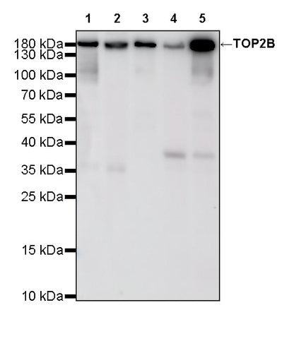 TOP2B Recombinant Rabbit mAb (S-4452-44)