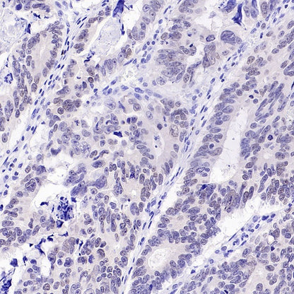 TCF1/TCF7 Recombinant Rabbit mAb (S-3486)