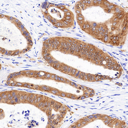 IMP3 Recombinant Rabbit mAb (S-6196)