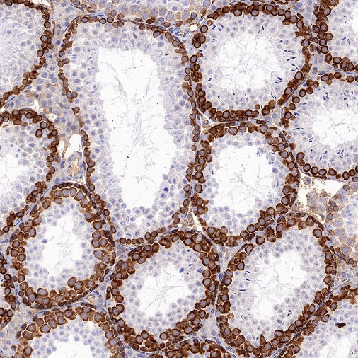 DAZL Rabbit Polyclonal Antibody