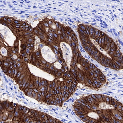 p120 Catenin Recombinant Rabbit mAb (SDT-350-75)