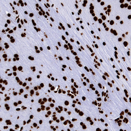 hnRNP U Recombinant Rabbit mAb (S-2375-23)