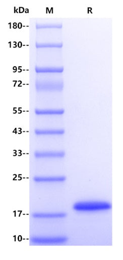 Human REG1A Protein, His Tag