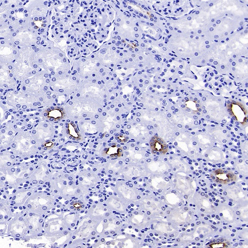 AQP2 Recombinant Rabbit mAb (SDT-2149-19)