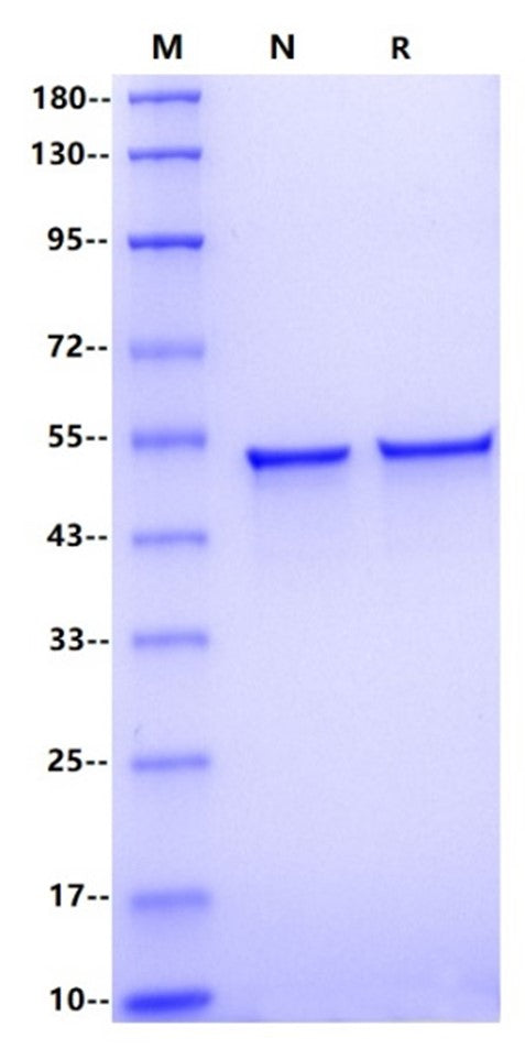 Nucleocapsid His Tag Protein, SARS-CoV-2