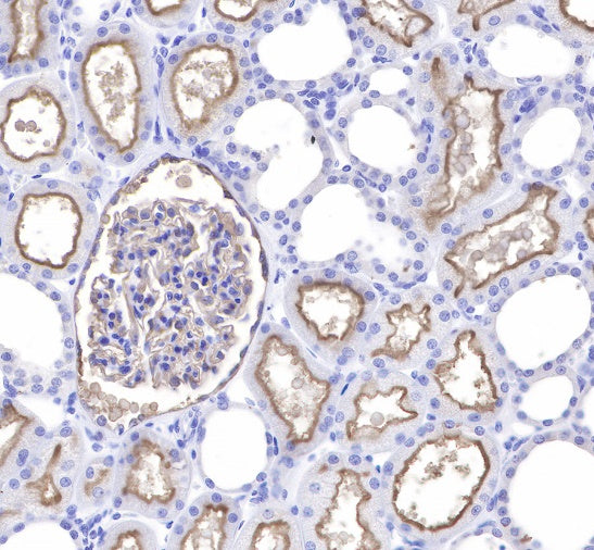 CD10 Recombinant Rabbit mAb (SDT-006-77)
