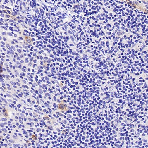 TNFRSF17/BCMA Recombinant Rabbit mAb (S-4674)