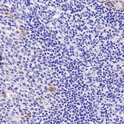 TNFRSF17/BCMA Recombinant Rabbit mAb (S-4674)