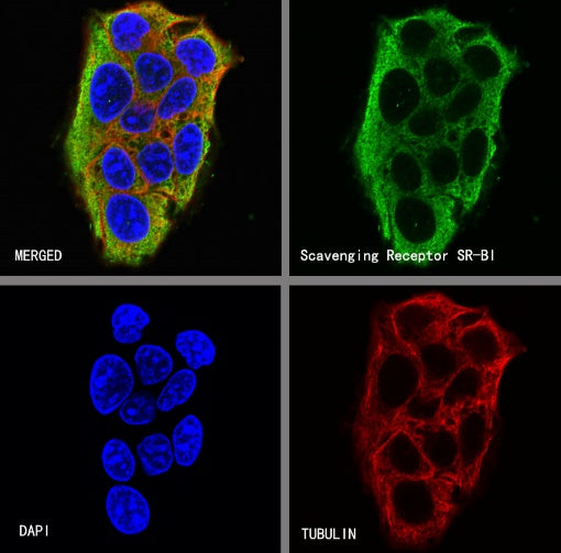 Scavenging Receptor SR-BI Recombinant Rabbit mAb (S-1736-15)