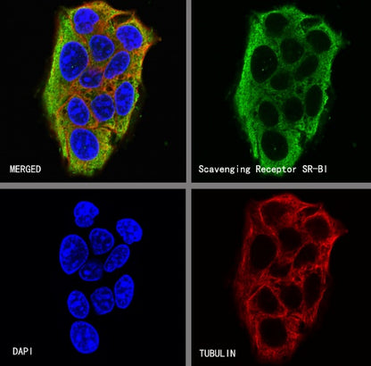 Scavenging Receptor SR-BI Recombinant Rabbit mAb (S-1736-15)