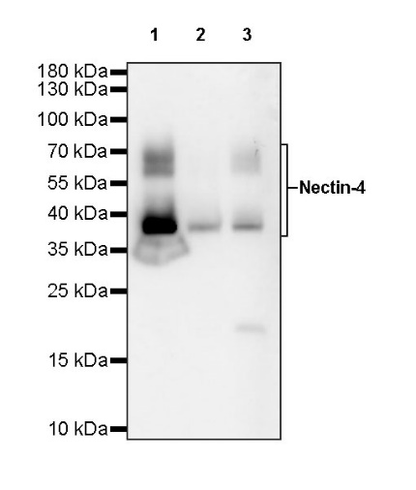 Nectin-4 Recombinant Rabbit mAb (SDT-277-314-1)