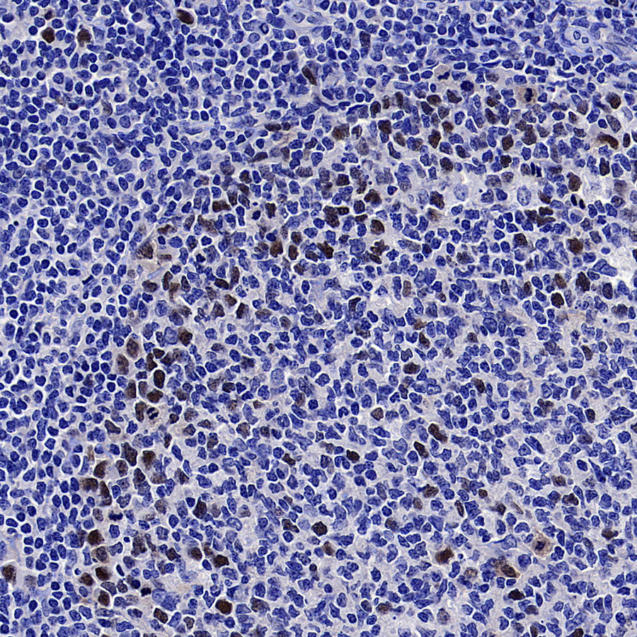 Skp2 Recombinant Rabbit mAb (S-4906)