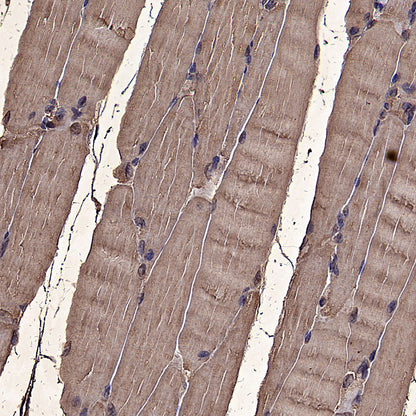 ALDOA Mouse mAb