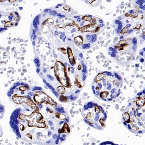 FABP4 Recombinant Rabbit mAb (S-1360-58）