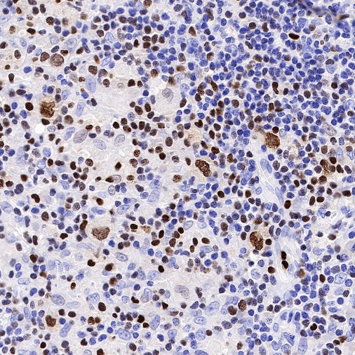T-bet/TBX21 Recombinant Rabbit mAb (S-583-54)