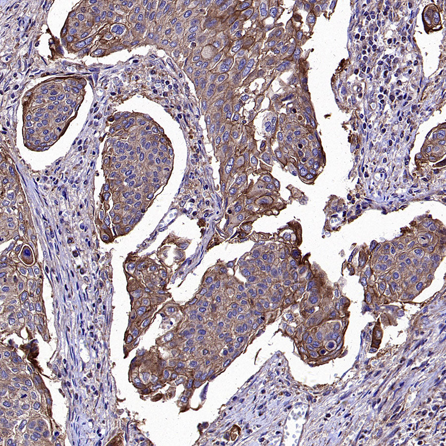 ADAM9 Recombinant Rabbit mAb (S-3270-74)