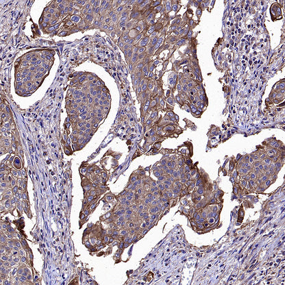 ADAM9 Recombinant Rabbit mAb (S-3270-74)