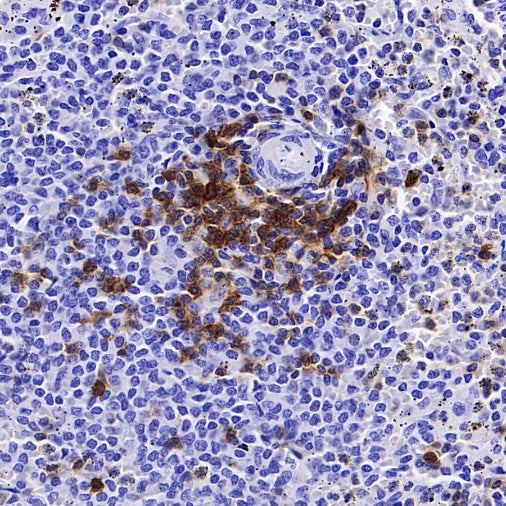 CD5 Recombinant Rabbit mAb (SDT-2570-53)
