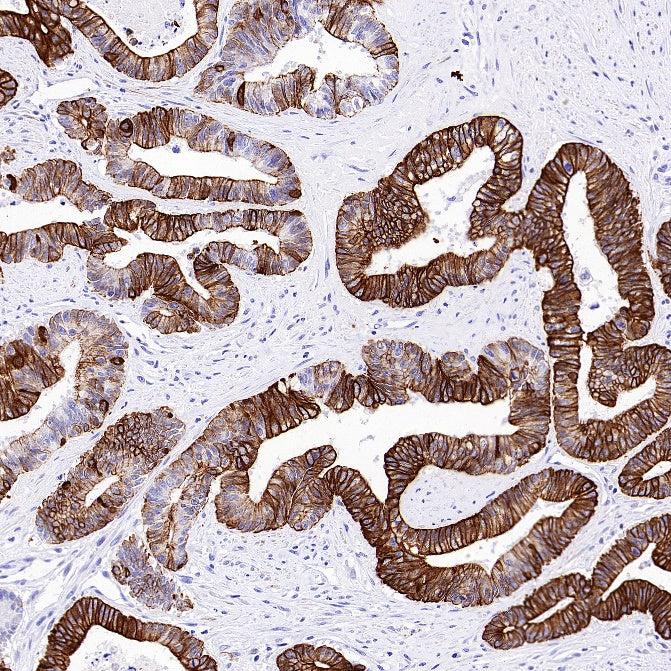 Anti-Rabbit and Mouse HRP-DAB IHC Secondary Antibody (2-step)