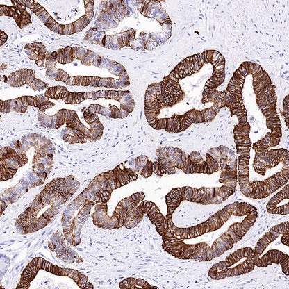 Anti-Rabbit and Mouse HRP-DAB IHC Secondary Antibody (2-step)