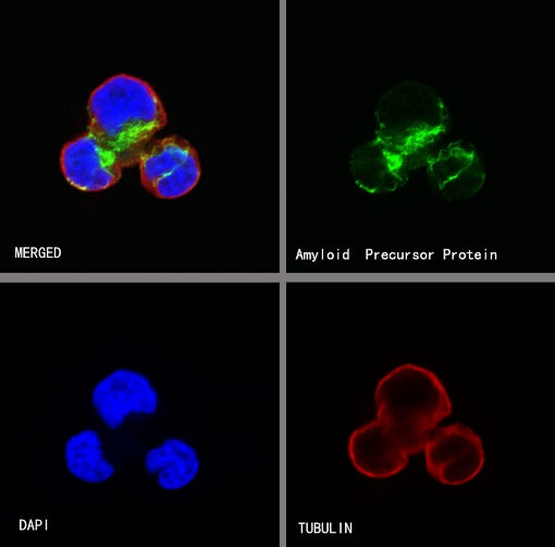 Amyloid Precursor Protein Recombinant Rabbit mAb (S-806-13)