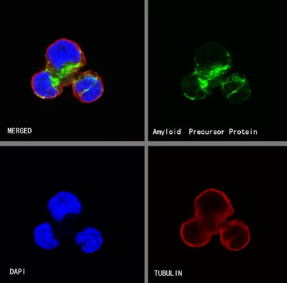 Amyloid Precursor Protein Recombinant Rabbit mAb (S-806-13)